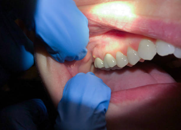 Best Walk-In Emergency Dentist in Eldorado, IL