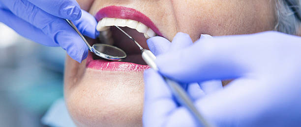 Best Emergency Dental Surgery in Eldorado, IL
